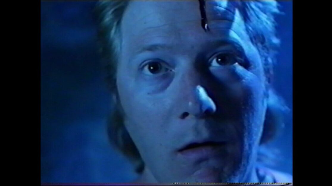 A bro with a mullet looks dazed as blood trickles down his forehead.